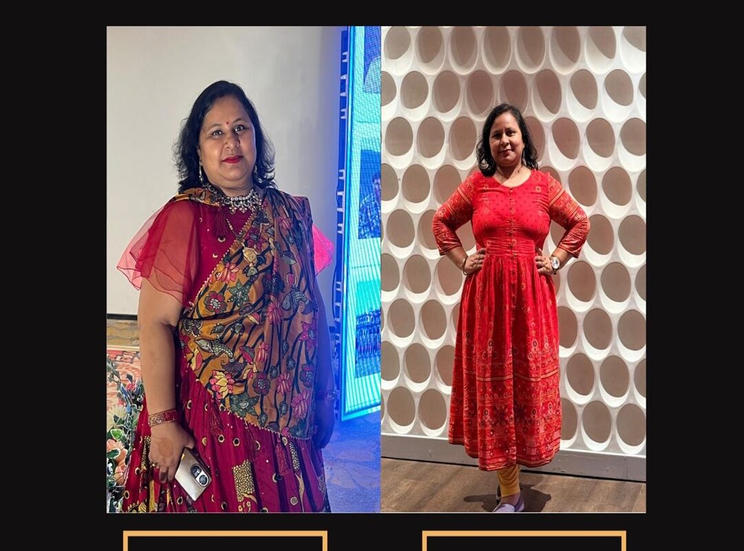 PCOS Weight Loss Expert