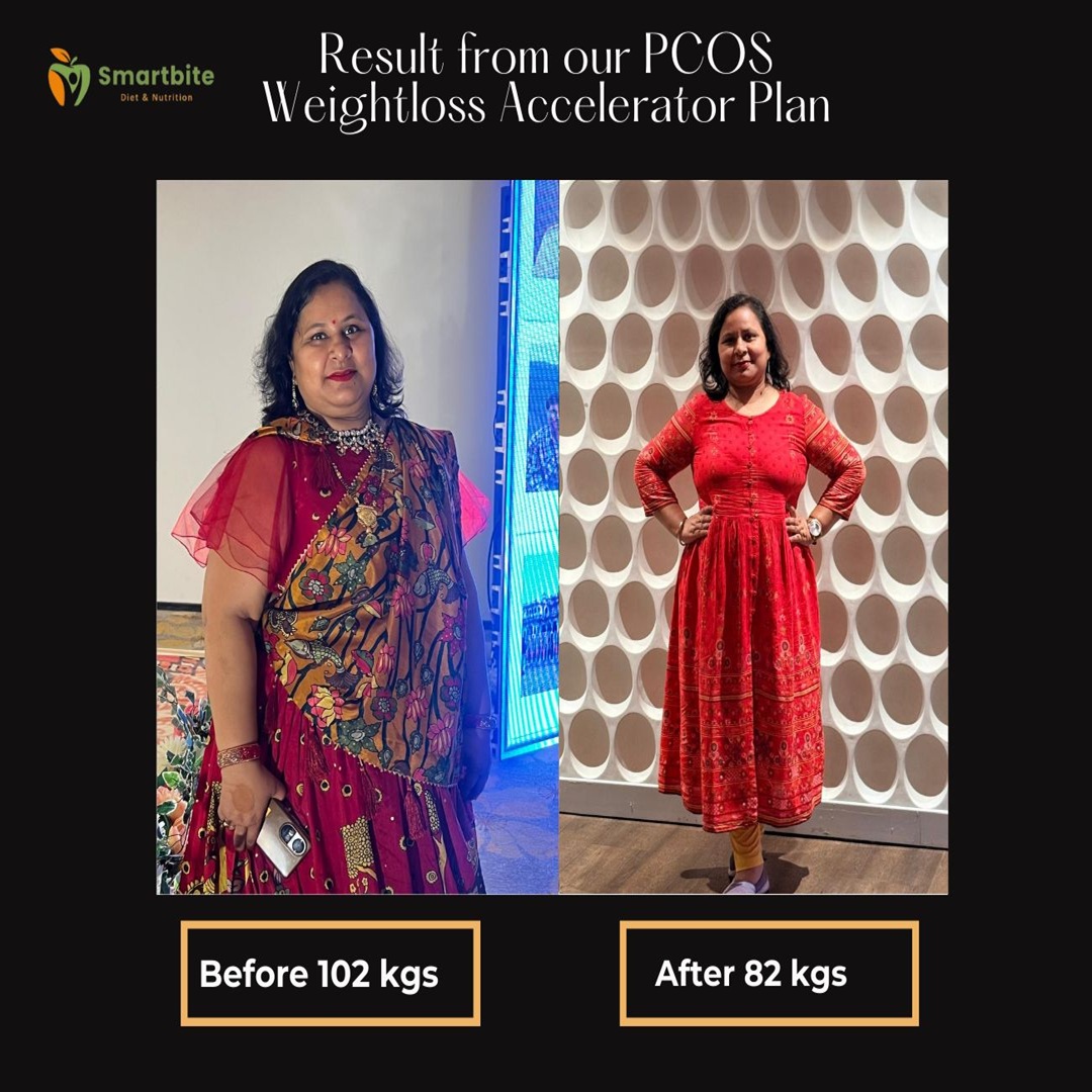 PCOS Weight Loss Expert