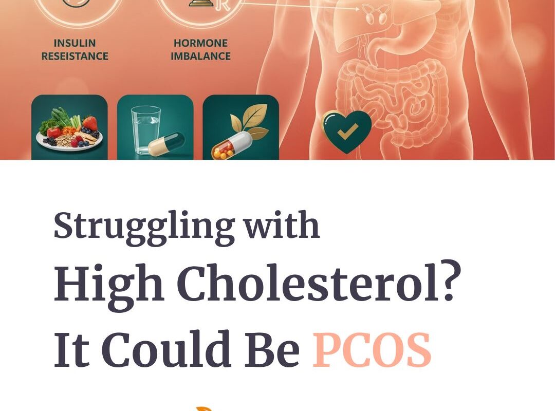 Struggling with High Cholesterol It Could Be PCOS
