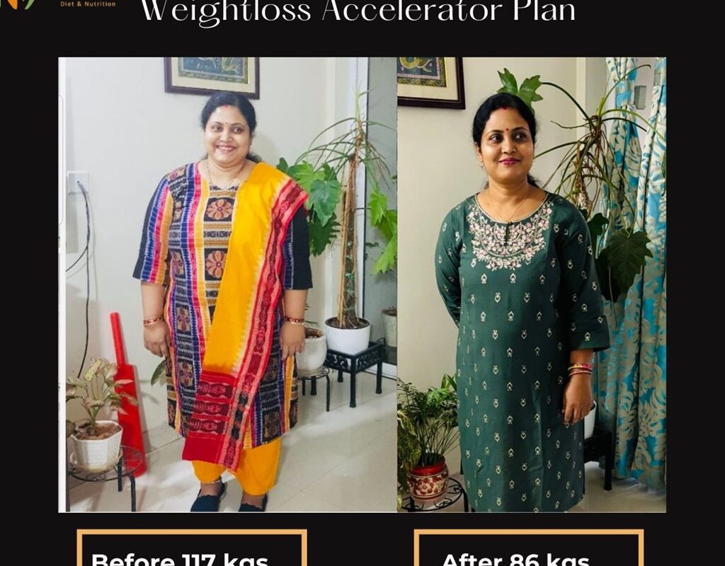 How SmartBite Nutrition Is Transforming PCOS Care for Women in Bangalore