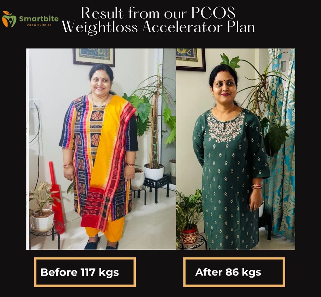 How SmartBite Nutrition Is Transforming PCOS Care for Women in Bangalore